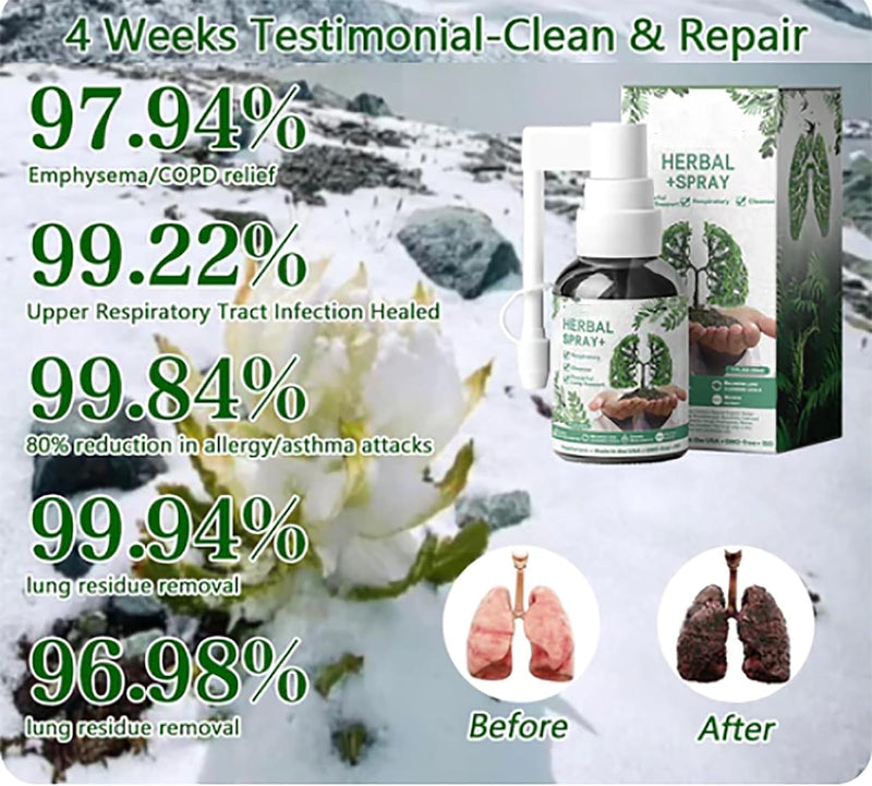 2 Pcs Respinature Herbal Lung Cleanse Mist-Powerful Lung Support, 30 ml Herbal Spray, Herbal Body Care Essence, Suitable for Daily - NewNest Australia