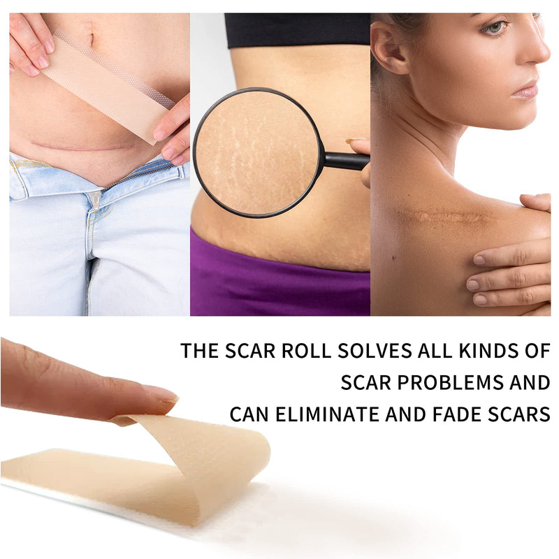 Silicone Scar Removal Roll (3M-1.6” x 120”), Scar Removal Strips Medical Grade, Scar Sheets Reusable, Scar Tape Professional for C-Section, Surgery, Burn, Keloid, Acne 1.5m-1.6” X 120”roll - NewNest Australia