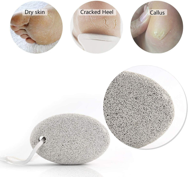 kuou 2 Pcs Pumice Stone, White Calluse Remover Natural Pumice Stone for Feet Hard Skin Callus - NewNest Australia