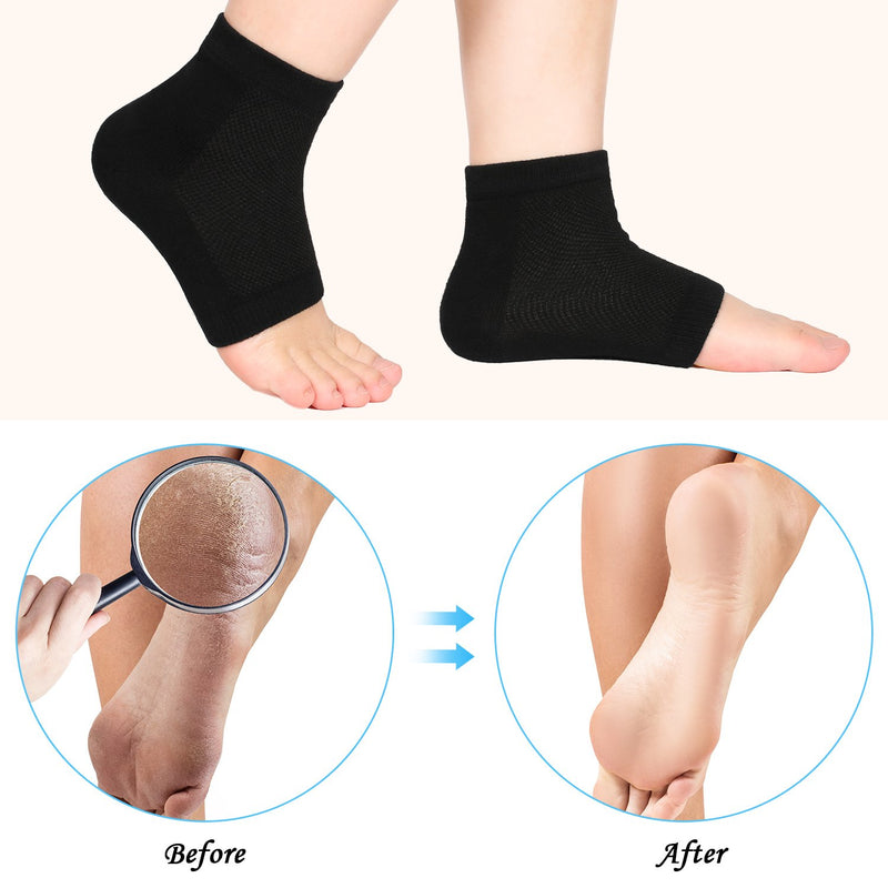 Bememo 3 Pairs Soft Ventilate Gel Heel Socks Open Toe Socks for Dry Hard Cracked Skin Moisturizing Day Night Care Skin (Black, Regular Size) Black - NewNest Australia