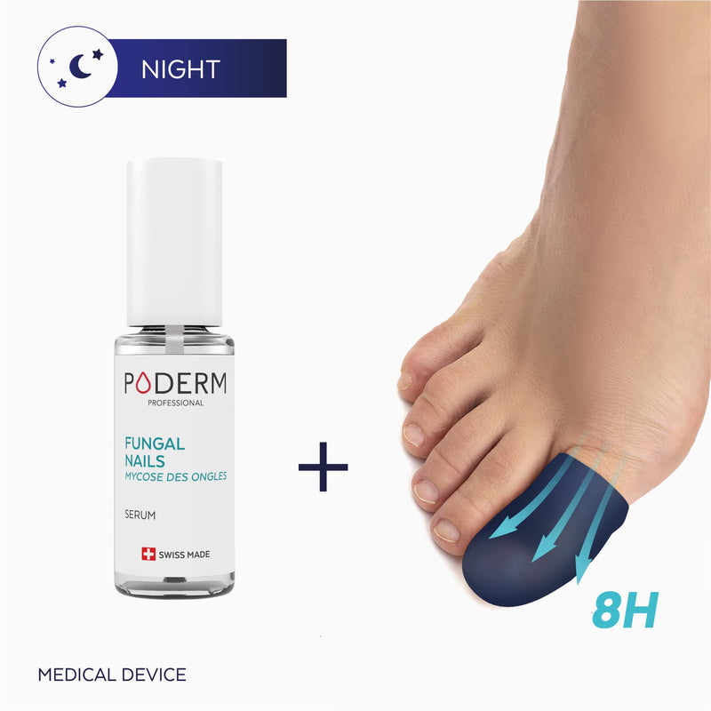PODERM – 2-in-1 FUNGAL NAIL INTENSIVE NIGHT TREATMENT Eliminates the fungal infection and renews the nail while you sleep |VEGAN | Professional foot/hand treatment | Quick & Easy | Swiss Made - NewNest Australia