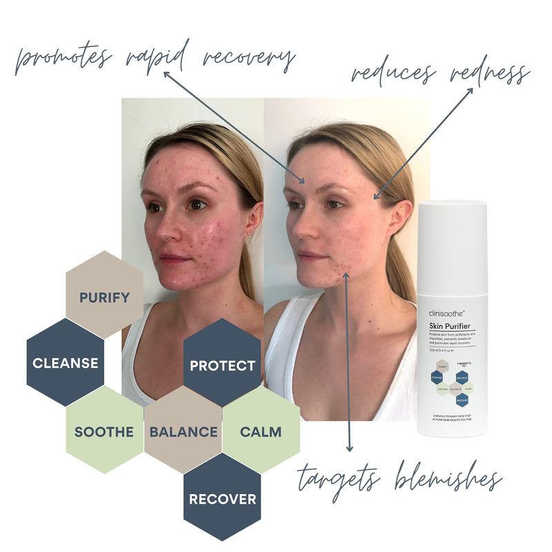 Clinisoothe+ Skin Purifier 250 ml (Pack of 1), Clear - with hypochlorous technology to protect the skin from pollutants and impurities, prevent breakouts and promote rapid recovery 250 ml (Pack of 1) - NewNest Australia