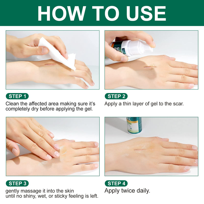 Silicone Scar Gel- Scar Removal Cream Gel, Stretch Mark Cream, Medical Advanced Scar Gel for Old and New Scar, Scar Cream for Surgical Scars, C-Section, Keloid, Acne Scars, Gentle Formula 50ML Green - NewNest Australia