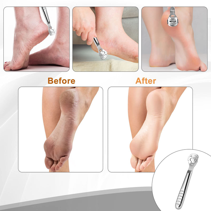 Callus Slicer Foot Scraper - Foot File Callus Remover Feet Callus Razor - Stainless Steel Foot Rasp Hard Skin Heel Callus Removal Pedicure Set For Hand Feet Foot Care With 10 Replacement Blades Silver - NewNest Australia