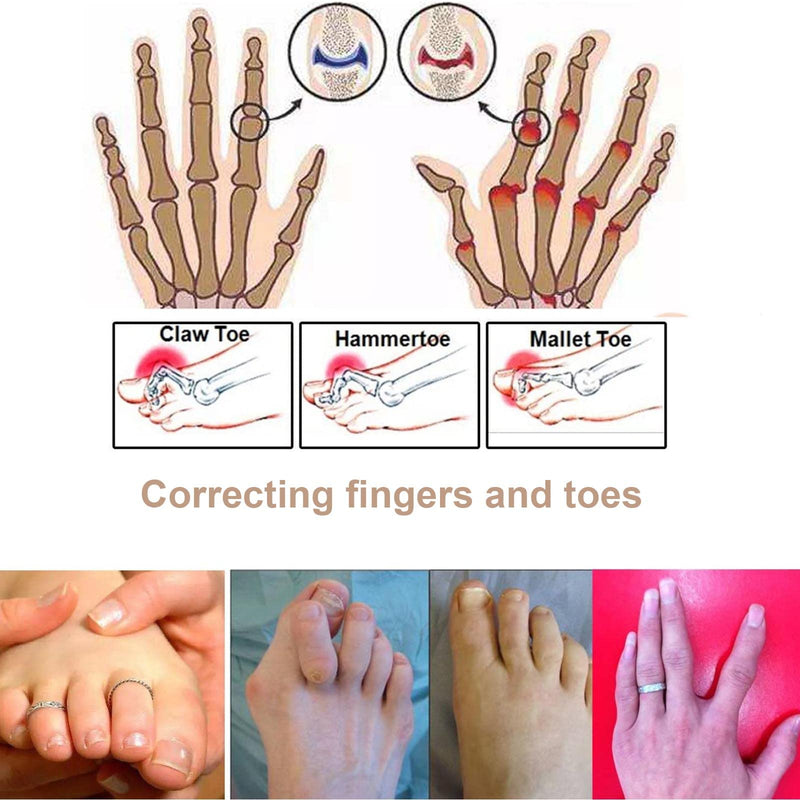 AYNKH 3PCS Finger Buddy Wraps Tapes, Fabric Toe Brace Splint Cushioned Bandages Finger Protectors for Jammed Swollen Dislocated Finger Joint - NewNest Australia