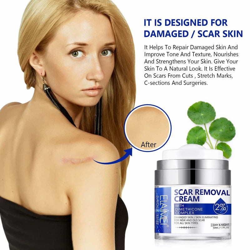 Scar Removal Cream, Skin Repair Cream for Old and New Scars, Scar Treatment Gel for Surgical Scars, Acne Scars, C-Section, Burns, Stretch Marks - NewNest Australia