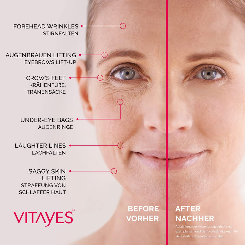 Vitayes Instant Ageback, Ageless facelift cream - anti aging cream - Instantly reduce under-eye bags, fine lines, deep wrinkles and pores. Lasts up to 9 hours. 7ml - NewNest Australia