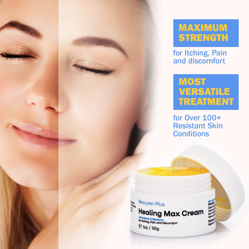 Recuren Plus Healing Max Cream Max Strength for Dermatitis Eczema Psoriasis Athletes Foot Jock Itch Urticaria Rash Rosacea Acne Ultimate Anti-Itch Solution - NewNest Australia