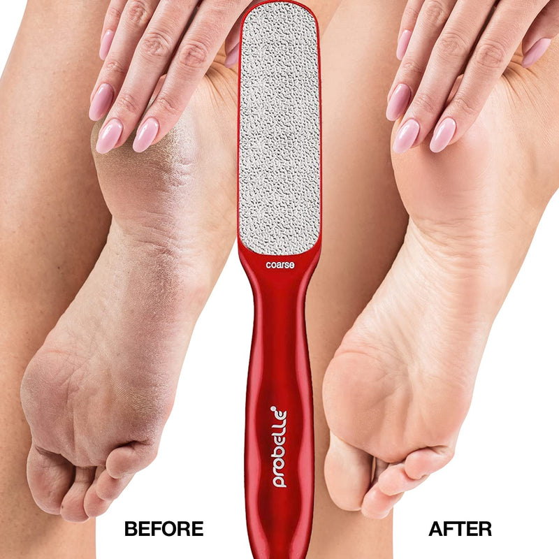 Probelle Double Sided Multidirectional Nickel Foot File Callus Remover - Immediately Reduces calluses and Corns to Powder for Instant Results, Safe Tool (Red) Red - NewNest Australia