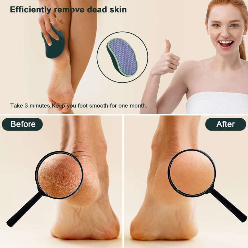 SIRALMNO Upgrade 2-in-1 Nano Glass Callus Remover,Foot scraper which used wet and Dry Callus Removal,Foot Rasp for Hard&dead Skin foot care,Safe & Portable foot file - NewNest Australia
