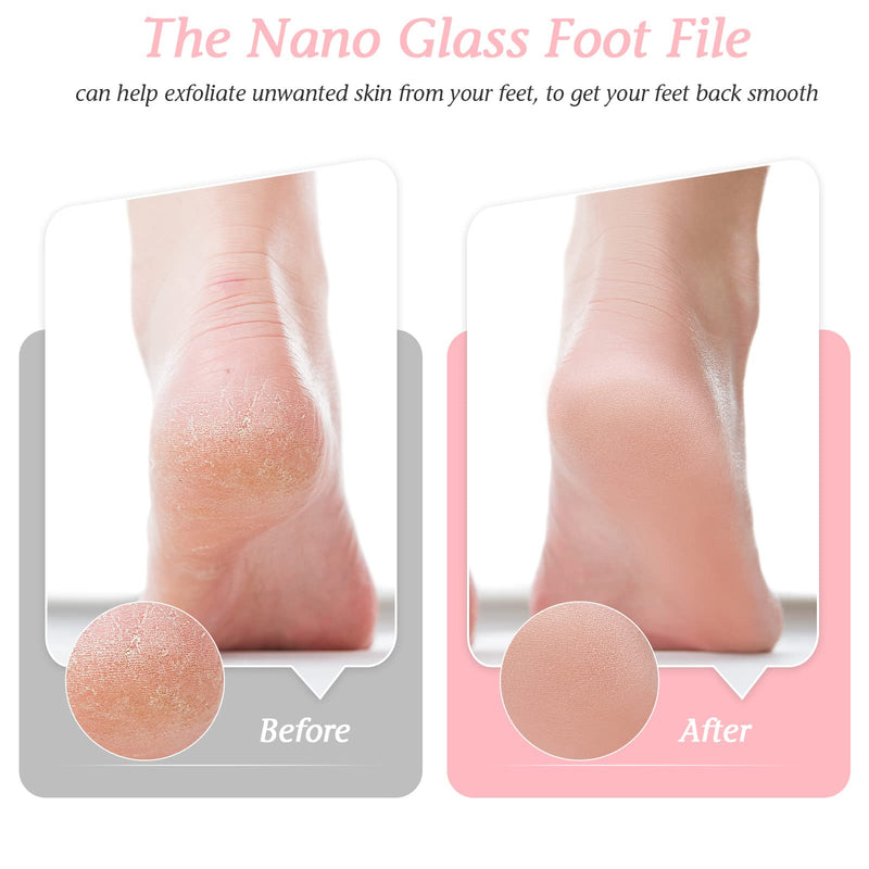 Foot Files for Hard Skin Nano Glass Foot File Fast Easy Feet Hard Skin Remover Essential Callus Remover for Feet Salon Pedicure Tool Remove Unwanted Dry Skin Calluses Cracked Heels Dead Skin Remover - NewNest Australia