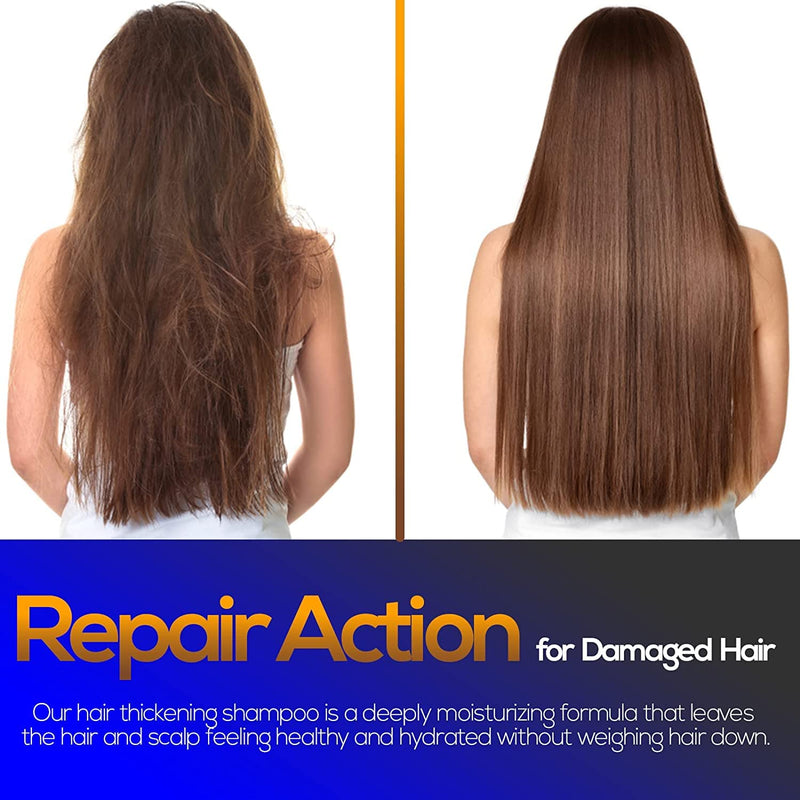 Biotin DHT Blocker Anti Dandruff Hair Growth Shampoo | Dry Scalp Hair Thinning Dermatitis Shampoo | Itchy Scalp Shampoo - Hair Loss Treatment for Women & Men - Biotin for Support Hair Growth - 473 ml - NewNest Australia