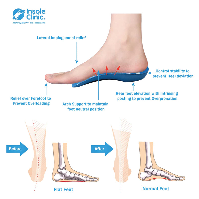 Insole Clinic® 3/4L Orthotic Insoles, Plantar Fasciitis Medial Arch Support Men Women, Overpronation Foot, Flat Feet Shoe inserts For Shin Splint Sports Metatarsalgia Heel Tendon Pain Treatment Large Blue - Medium Density - NewNest Australia