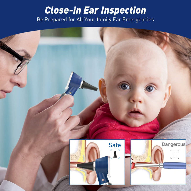 Scian Otoscope Kit - Ear Scope Otoscope With Led Light, 3X Magnification, 4 Speculum Tips Size, Lightweight Diagnostic Ear Care Tool For Children, Adults, Dogs, Home Use (Blue) - NewNest Australia