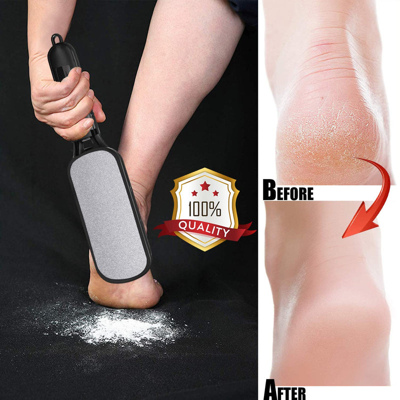 Foot File, Double Sided Foot Scrubber Callus Remover for Feet, Foot Rasp, Professional Pedicure Tool to Remove Callus, Plantar Wart, Corn - Skin-friendly Metal Foot Files for Hard Skin - NewNest Australia