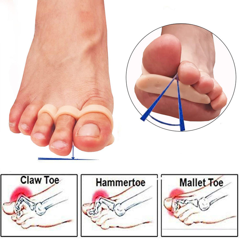 Mcvcoyh Gel Hammer Toe Crests Pads x 10 Pcs Silicone Toe Straightener Cushion Support Pain Relief for Hammer Toe, Overlapping Toes, Curled Toe-3 Loops Light Nude - NewNest Australia