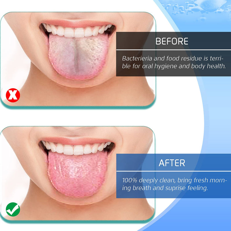 4PCS Tongue Scraper, Stainless Steel Tongue Cleaners, 100% BPA Free Fresher Tongue Tools, Healthy Oral Hygiene Brushes, Medical Grade Reusable Stainless Steel, Eliminate Bad Breath - NewNest Australia