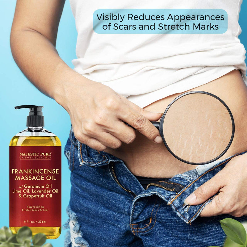 Stretch Mark and Scar Frankincense Massage Oil by Majestic Pure, for Softer & Smoother Skin - Visibly Reduces Appearances of Scars and Stretch Marks - 8 fl oz - NewNest Australia