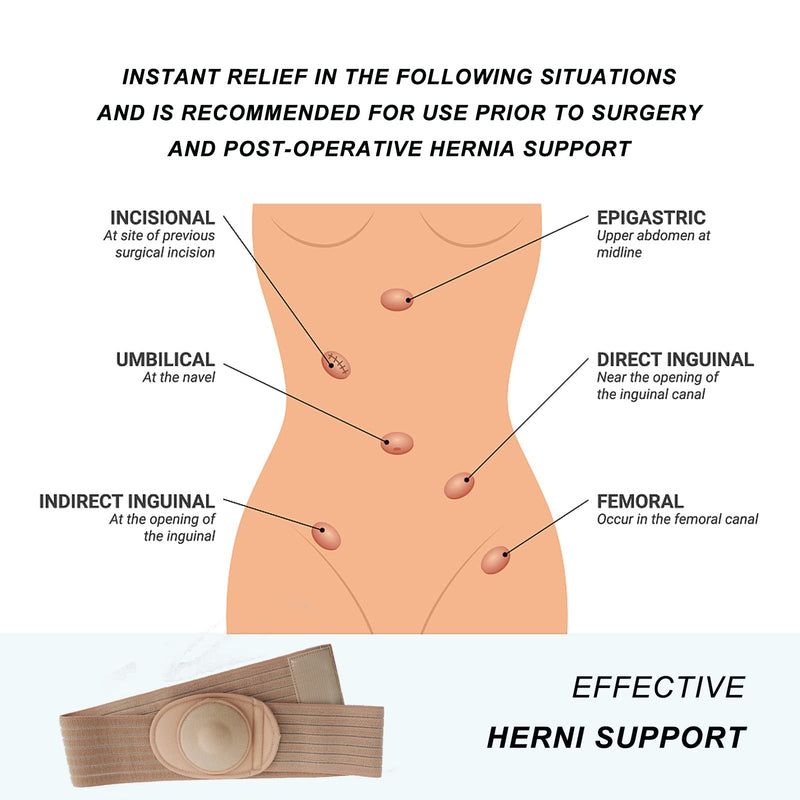 Umbilical Hernia Belt | Abdominal Hernia Belt for Men & Women | Belly Button Umbilical Hernia Binder w/ 1 Hernia Compression Pads | Ventral, Epigastric & Post Surgery Support Belts X-Large - NewNest Australia