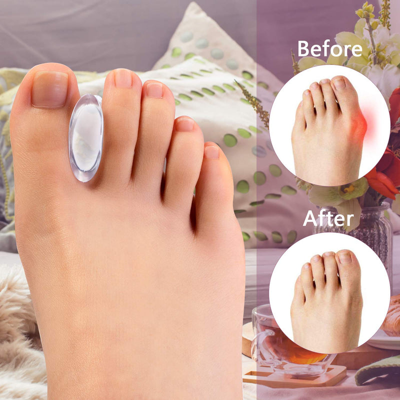 Promifun Gel Toe Separators to Straighten Overlapping Toes, 12 Packs of Toe Spacers for Bunion and Corns, Corrector Pads for Crooked Toes, Calluses, Bunions Transparent - NewNest Australia