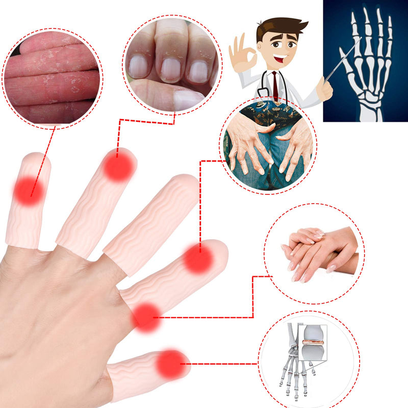 Finger Cots, Gel Finger Tips Protector, Finger Covers (14PCS, L size), New Material (Latex-Free), Finger Sleeves Great for Finger Cracking, Dermatitis, Psoriasis, Hand Eczema and More. Beige(L SIZE) - NewNest Australia