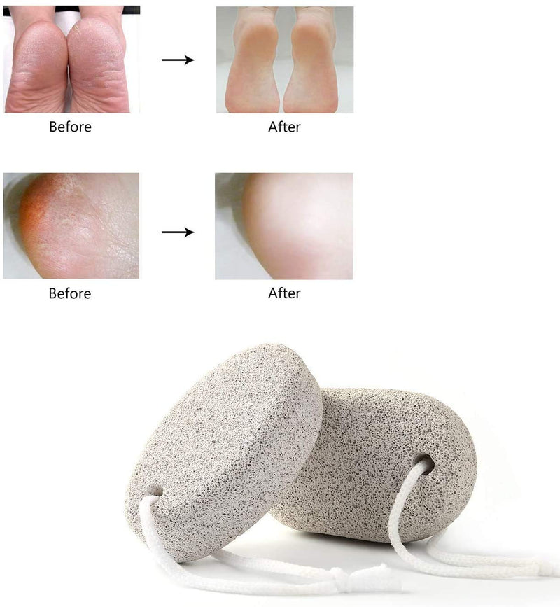 kuou 2 Pcs Pumice Stone, White Calluse Remover Natural Pumice Stone for Feet Hard Skin Callus - NewNest Australia