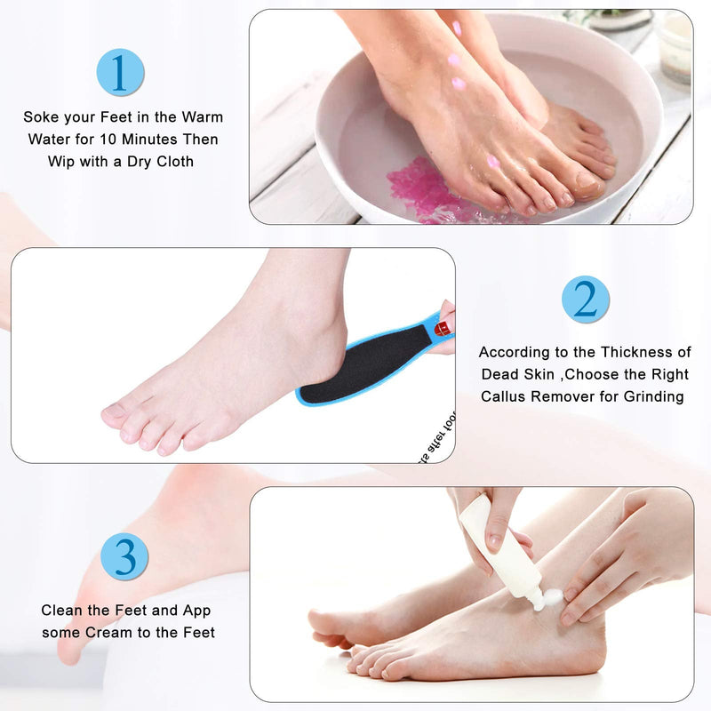 ZOUYUE Electric Foot File Pedicure Kit,Rechargeable Waterproof Hard Skin Remover with 3 Rollers and 2 Speeds,Stainless Steel Foot Care Gift Set for Dry Dead Cracked Feet and Dead Skin White - NewNest Australia