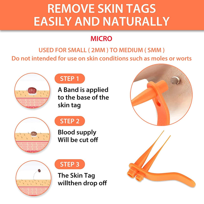 Mole Removal Skin Tag Removal Micro Band Skin Tag Removal Kit Face Body Care Painless and Safe 2 in 1 Professional Mole Wart Remover., Orange - NewNest Australia