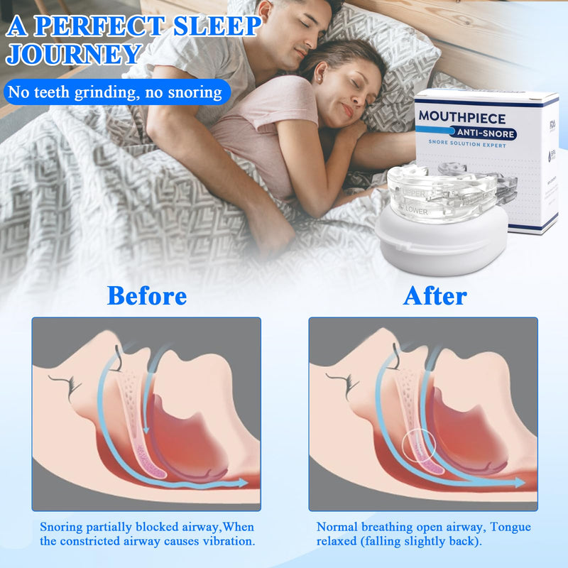 Mouth guard for teeth grinding, bite splints, mouth guard, bite splint, bruxism mouth guard for grinding, grinding mouthpiece, effective teeth grinding, prevent bruxism - NewNest Australia