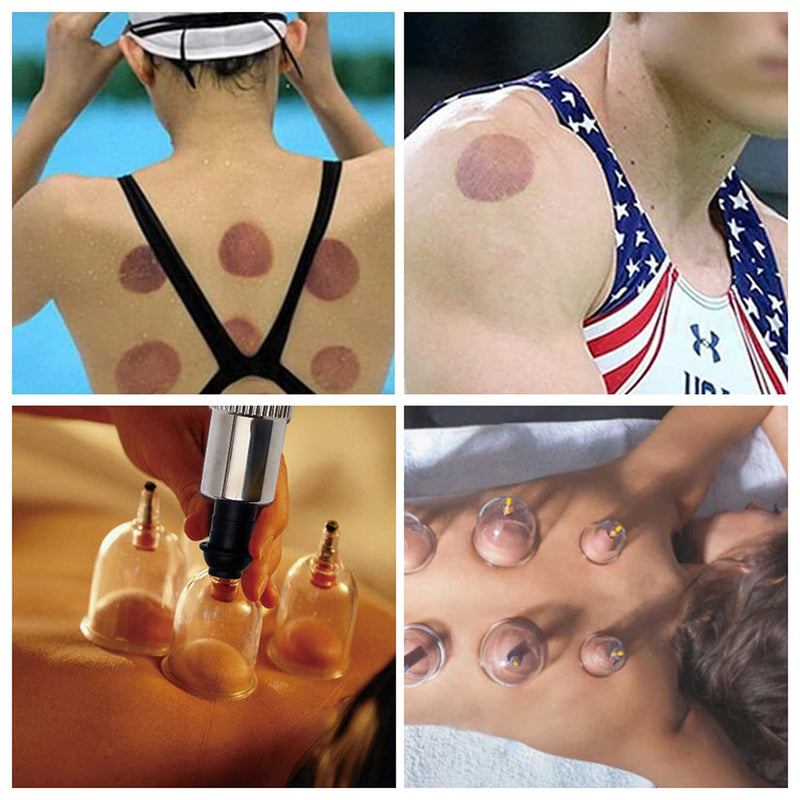 Cupping Therapy Set,12 Therapy Cups Cupping Set with Pump, Professional Chinese Cupping Therapy Sets Hijama Cupping Massage Kit 12 Cups - NewNest Australia