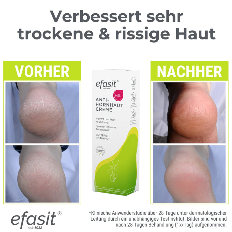 Efasit Anti-Callus Cream, 75 Ml, Callus Remover Cream With Acid Complex For Callused Feet, Inhibits Callus Reformation, Callus Reduction Cream Delivers Visible Results After 4 Days - NewNest Australia