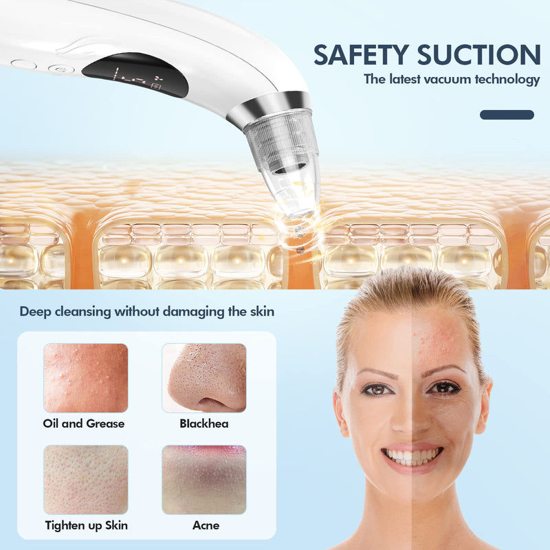 2023 Newest Blackhead Remover Pore Vacuum, Upgraded Black Head Remover for Face, Electric Acne Comedone Whitehead Extractor Tools-5 Suction Power, 5 Probes, USB Rechargeable Pimple Popper Tool Kit - NewNest Australia