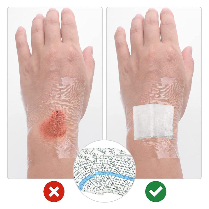 Waterproof Transparent Bandage, Pack Of 50 Tattoo Plasters, Various Sizes, Tattoo Film Healing, Transparent Bandage For Anti-Allergic, Sports, Showers, Medical Plasters, Wound Pad - NewNest Australia