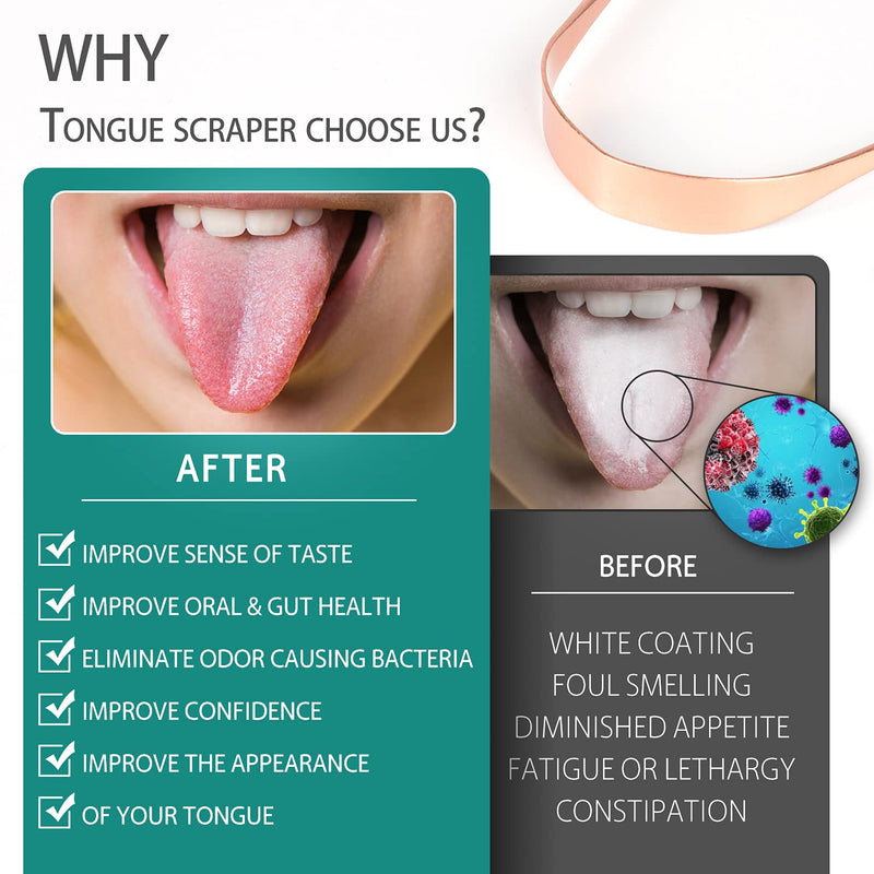 100% Pure Copper Tongue Scraper With Travel Case - Pack Of 2, Naturally Antimicrobial, Eliminates Bad Breath And Maintains Oral Hygiene, Tongue Cleaner For Adults And Children, Easy To Clean U-Copper - NewNest Australia