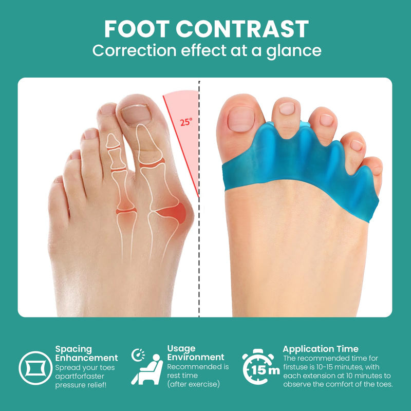 Welnove Silicone Toe Separators For Correct Hallux Valgus - 8 Pack Toe Separators For Men'S Feet - Hammer Toe Straightener For Women, Yoga Exercises, Foot Alignment - Blue - NewNest Australia