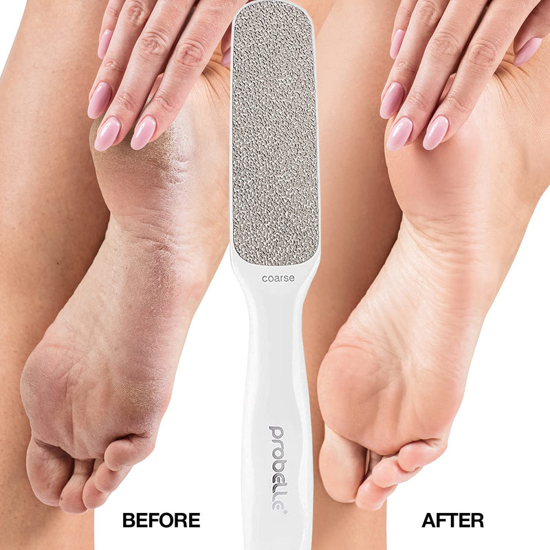 Probelle Double Sided Multidirectional Nickel Foot File Callus Remover - Immediately Reduces calluses and Corns to Powder for Instant Results, Safe Tool (White) White - NewNest Australia