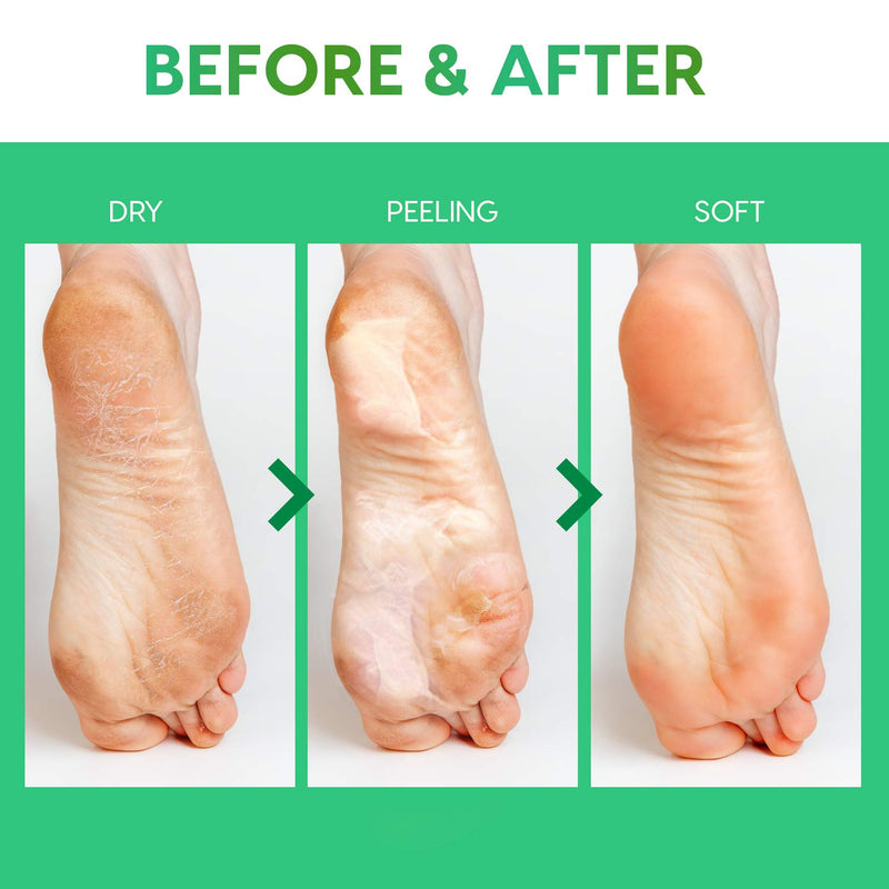 Avashine Foot Peel Mask, Repair Heels & Removes Dry Dead Skin, Calluses and Hard Skin for Soft Baby Feet, Foot Care For Men & Women - NewNest Australia