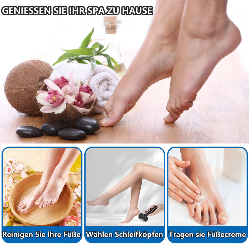 Callus Remover Electric, Rechargeable Callus Removal Foot with Strength Suction and 2 Levels Adjustable, Waterproof Professional Foot Care Pedicure (Black) Acrylonitrile Butadiene Styrene (ABS) - NewNest Australia