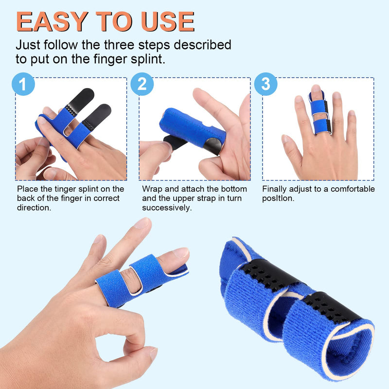 Altcompluser Pack Of 4 Finger Splints, Adjustable Finger Support, Finger Stabilizer With Built-In Aluminum Strap For Broken, Sprains, Arthritis, Tendonitis And Swollen Fingers - NewNest Australia