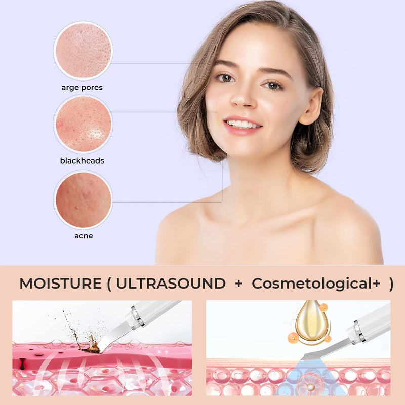 Skin Scrubber, ANLAN Ultrasonic EMS Ion Exfoliating Device Face Cleanser and Blackhead Remover Pores Cleaning Wrinkle Remover Comedone Extractor Skin Care With 4 Modes USB Rechargeable White-1 - NewNest Australia