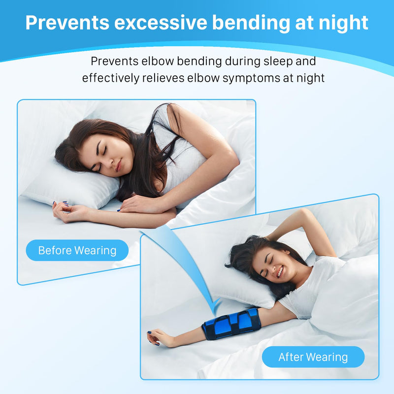 Elbow Splint For Cubital Tunnel Syndrome, Ulnar Nerve, Elbow Splint Bandage For Men And Women, Arm Splint For Left And Right, Elbow Bandage With Integrated 3 Support Plates, L/Xl - NewNest Australia