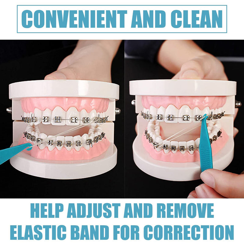Clyhon 10pcs Orthodontic Elastic Disposable Plastic Braces for Dental Braces Material Placement Removal Tools Elastic Rope Hook Elastic Hook Orthodontic - NewNest Australia
