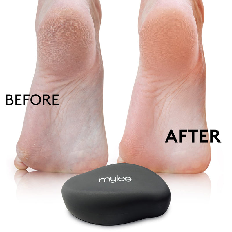 Mylee Crystal Foot File for Smooth Feet - Ultra Fine Glass Surface, Gently Removes Hard Skin, Works on Dry & Wet Feet, Easy to Clean & Sanitise Professional & Home Use, 5 Year Guarantee on the Surface - NewNest Australia