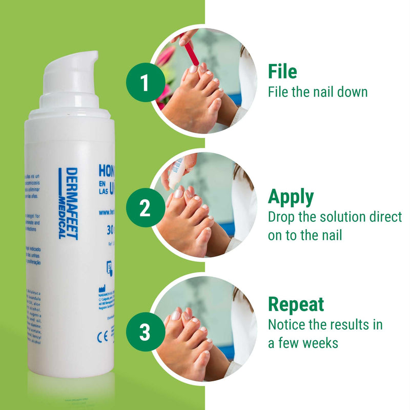 Dermafeet Medical - Medically approved and tested extra strong Nail Fungal Cream - Once a day treatment - quickly restores nails with fast noticeable results - NewNest Australia