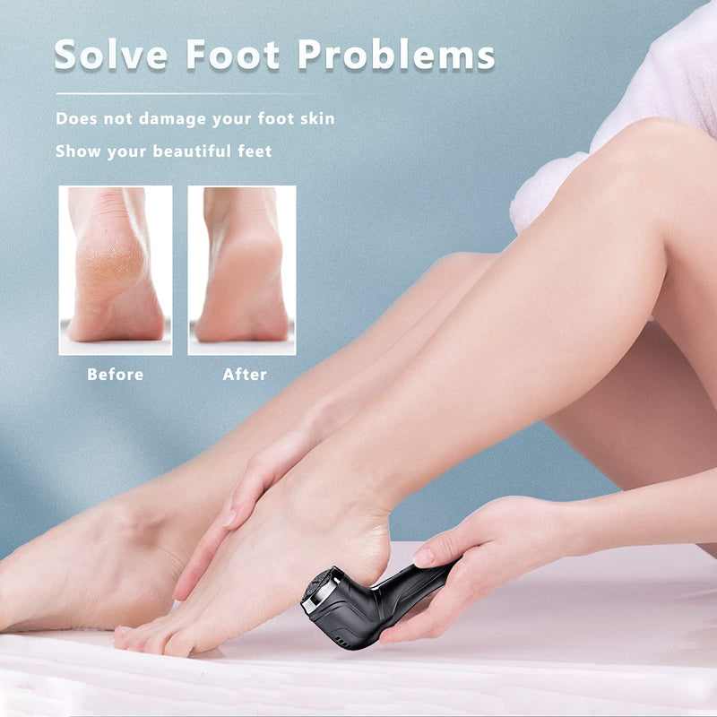 Callus Remover Electric Rechargeable Callus Removal Foot Electric Ipx7 Waterproof Led Display Pedicure Set Foot Care Electric With Vacuum System, 2 Speeds & 3 Grinding Heads - NewNest Australia