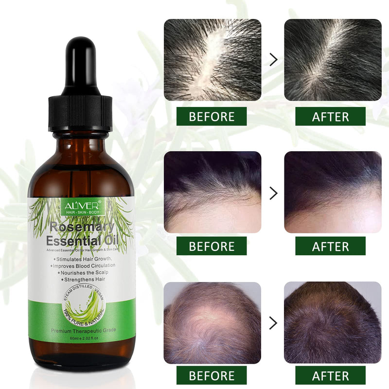 100% Pure Rosemary Essential Oil, Rosemary Oil (2 X 60 Ml) For Hair Growth, Hair Loss, Improvement Of Scalp, Eyebrows And Eyelash Growth, Aromatherapy And Skin Care - NewNest Australia