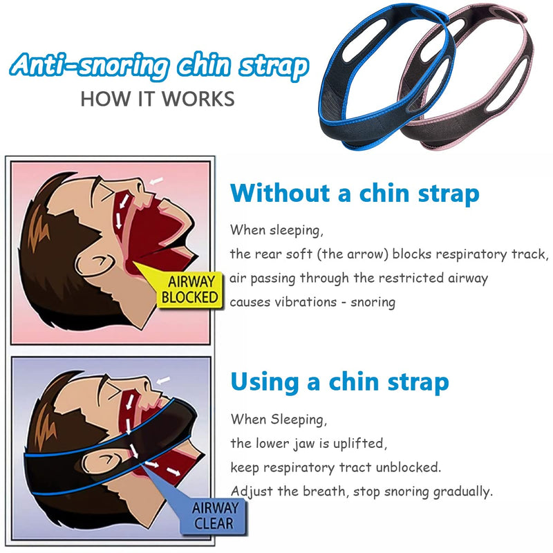 Yutou Anti Snoring Chin Strap Professional Effective Helps Against Snoring Device Anti Snoring Stopper Snoring Solution For Snoring Reduction For Men Women Pack Of 2 - NewNest Australia