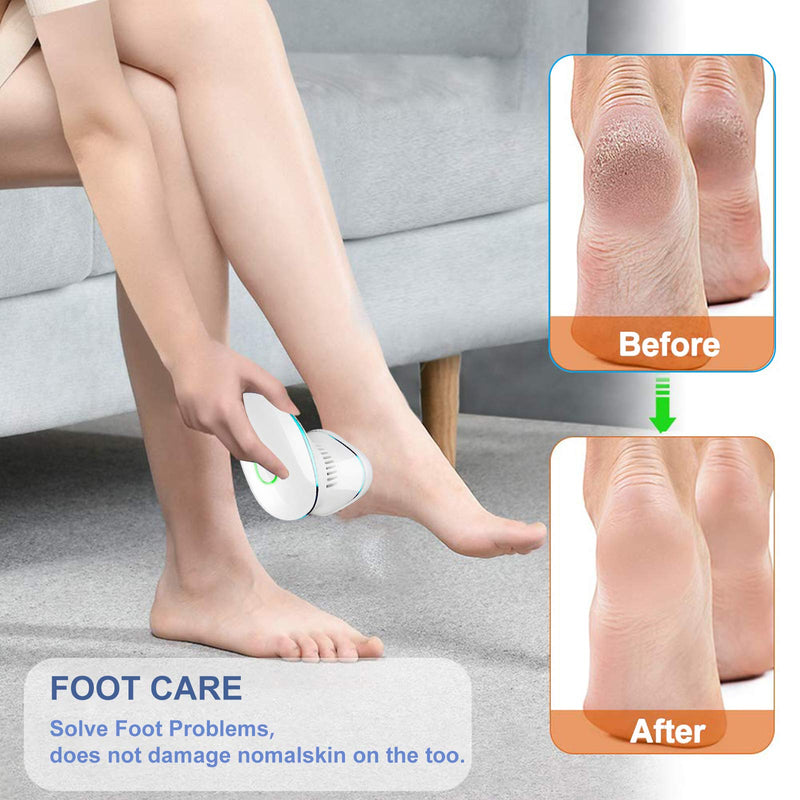 Electric Foot Callus Remover kit-Electric Foot File Pedicure Tools Built-in Vacuum,Electric vacum Foot Grinder,Professional Pedicure Tools Feet Care for Dead, Hard Cracked Dry Skin Blue - NewNest Australia