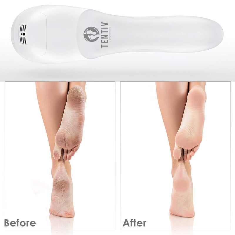 Tentiv Electric Foot File, Pedicure Set Hard Dead Skin Callus Remover for feet - NewNest Australia