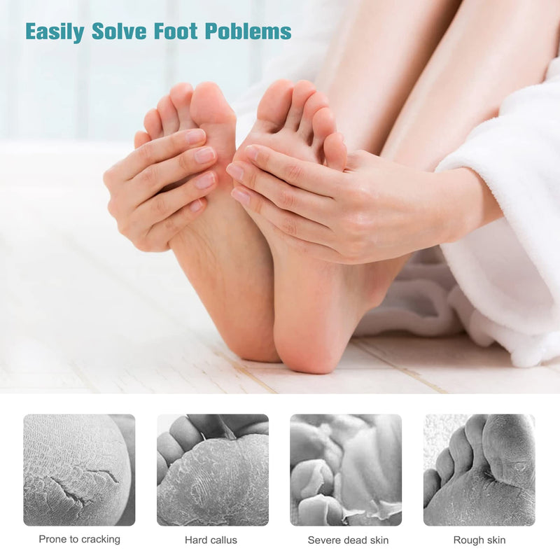 FVION Foot File Dead Hard Skin Remover – Pedicure Rasp Cracked Heels, Double Side Professional Callus Removal for Feet, Stainless Steel Foot Scraper for Feet Care - NewNest Australia